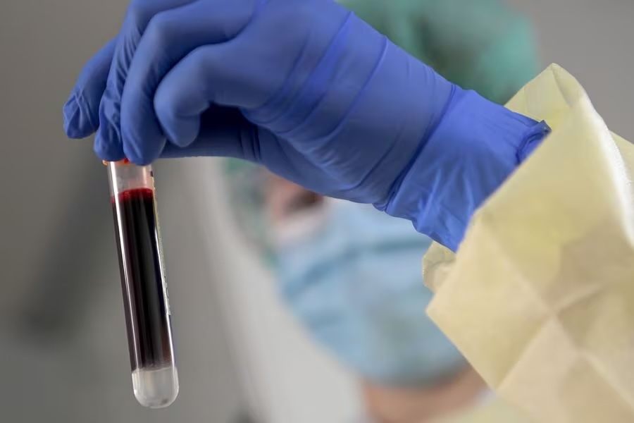 Foto de la mano de un tecnólogo médico, sosteniendo un tubo con una muestra de sangre.